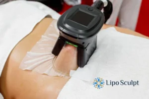 Cryolipolysis Helping You Getting that Perfect Summer Body 3 Cryolipolysis Camden can give you the best summer body - contact us today!