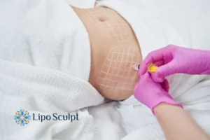 Are The Results From Aqualyx Permanent? 1 Do you want to know how long Aqualyx Camden results last?