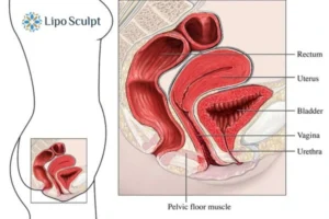 Treatment For A Leaky Bladder 2 How EM Chair treatment Camden can help Leaky bladder issues. Read more now!