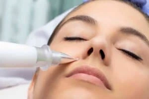 Best Actinic Keratoses Removal 3 Actinic keratoses Camden solutions - book in today!