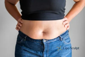 Bidding Farewell to Muffin Tops with Aqualyx Fat Injections 2 Do you wish you could reduce your muffin top Camden With Aqualy fat dissolving injections you can!